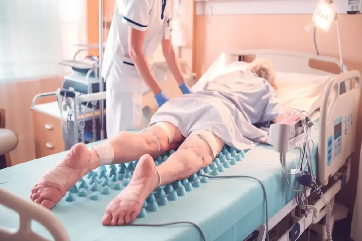 Úlceras de Pressão